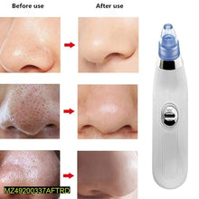 Derma Suction Facial Cleanser